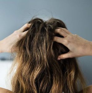 Scalp issues 